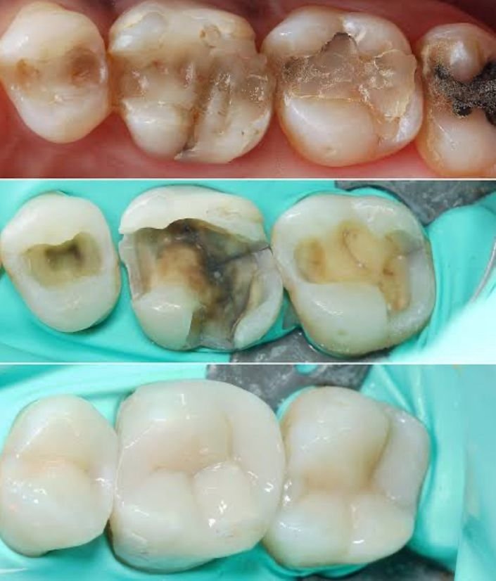 Reconstruções Dentárias